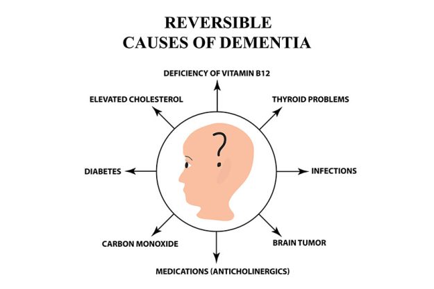 Reversible causes of senile dementia