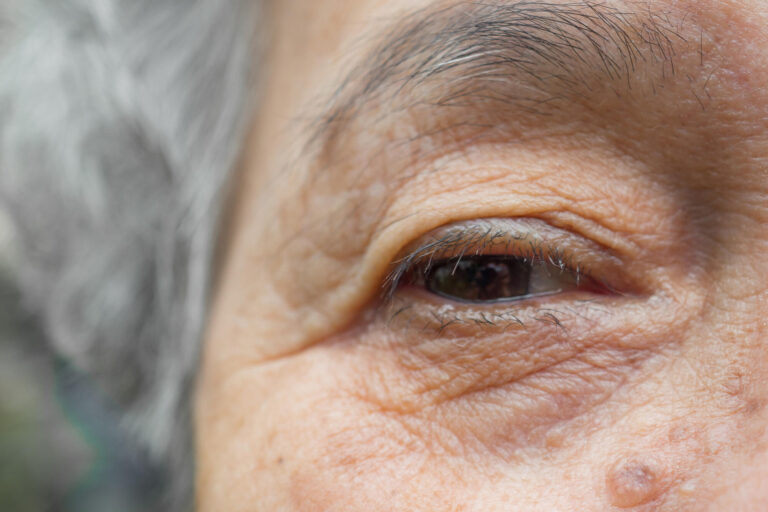 Close up photo of a senior woman right eye